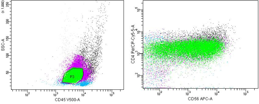 Marker analysis demonstrates coexpression of CD4 and CD56 within the blast population.